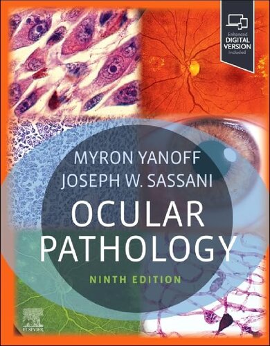 Ocular Pathology
