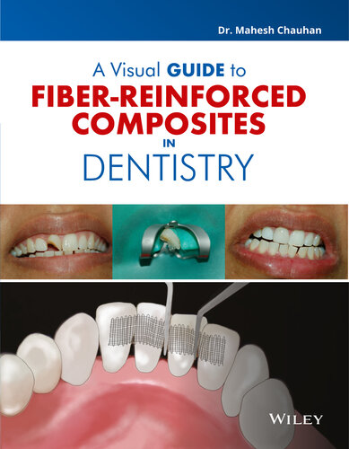 A Visual Guide to Fiber - Reinforced Composites in  Dentistry