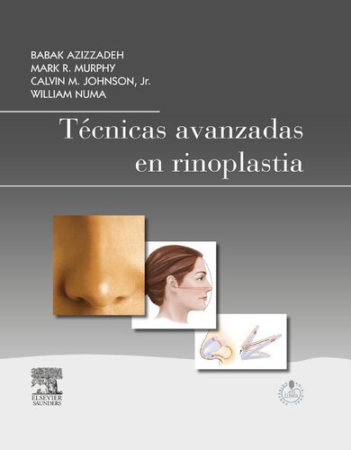 Técnicas avanzadas en rinoplastia