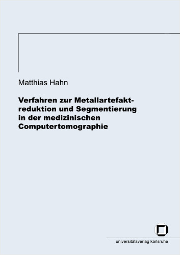 Verfahren zur Metallartefaktreduktion und Segmentierung in der medizinischen Computertomographie  German