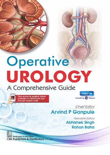Operative Urology Comprehensive Guide