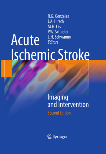 Acute Ischemic Stroke: Imaging and Intervention