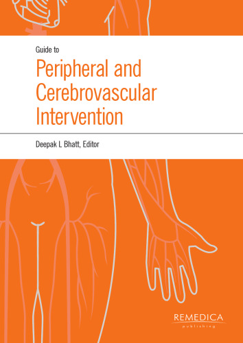 Guide to Peripheral and Cerebrovascular Intervention