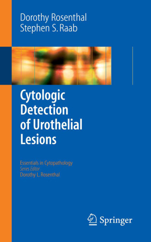 Cytologic Detection of Urothelial Lesions (Essentials in Cytopathology)