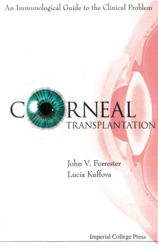 Corneal Transplantation: An Immunological Guide to the Clinical Problem