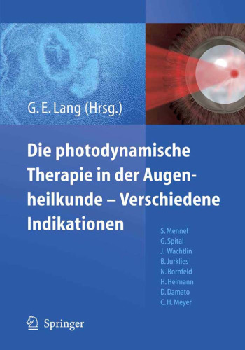 Die photodynamische Therapie in der Augenheilkunde - Verschiedene Indikationen (German Edition)
