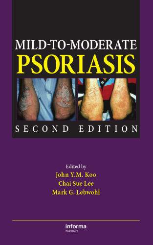 Mild-to-Moderate Psoriasis, Second Edition