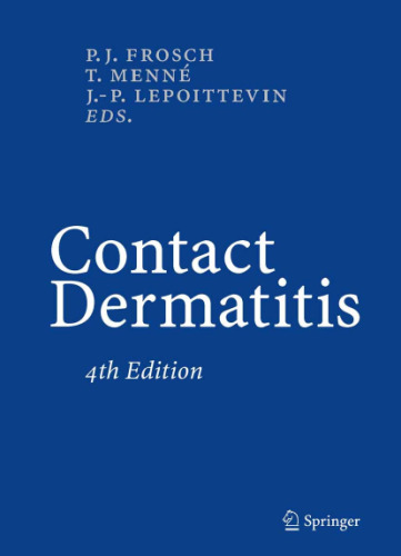 Contact Dermatitis
