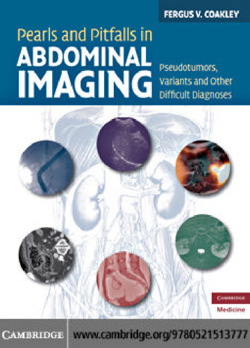 Pearls and Pitfalls in Abdominal Imaging: Pseudotumors, Variants and Other Difficult Diagnoses