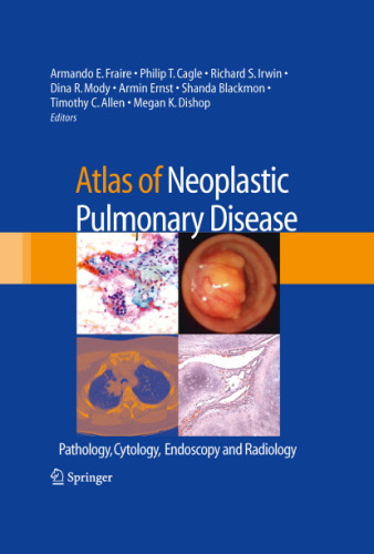 Atlas of Neoplastic Pulmonary Disease: Pathology, Cytology, Endoscopy and Radiology