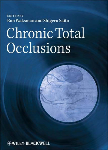 Chronic Total Occlusions