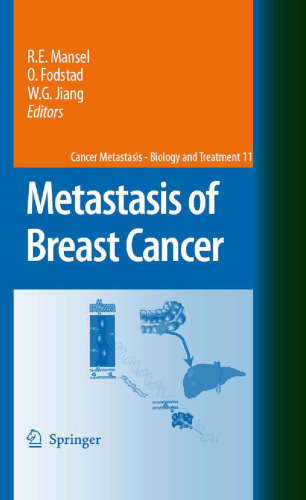 Metastasis of Breast Cancer (Cancer Metastasis - Biology and Treatment)