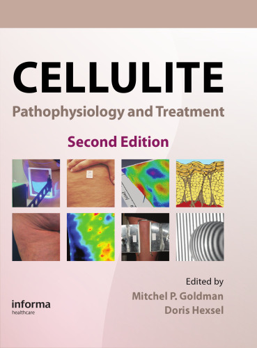 Cellulite: Pathophysiology and Treatment, 2nd Edition (Basic and Clinical Dermatology)