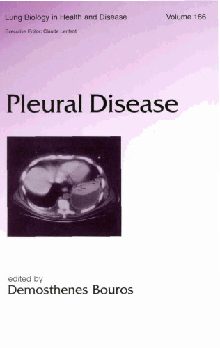 Lung Biology in Health & Disease Volume 186 Pleural Disease