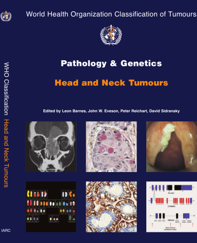 Pathology And Genetics of Head and Neck Tumours (World Health Organization Classification of Tumours)