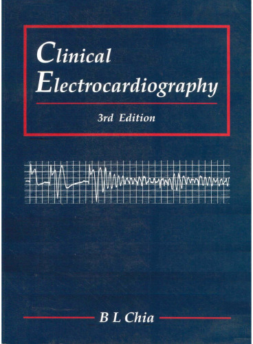 Clinical Electrocardiography