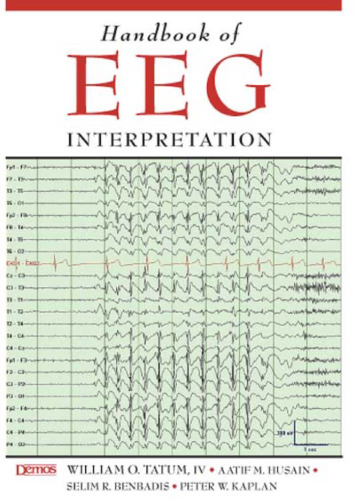 Handbook of EEG Interpretation