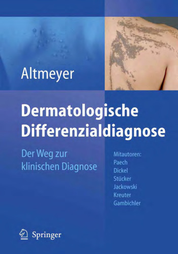 Dermatologische Differenzialdiagnose: Der Weg zur klinischen Diagnose