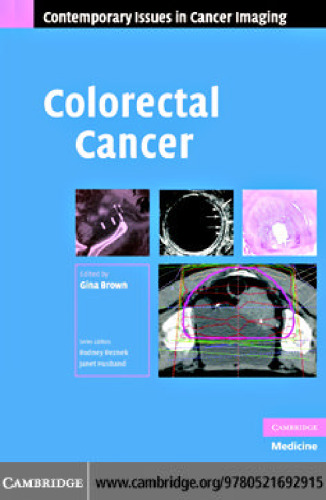 Colorectal Cancer (Contemporary Issues in Cancer Imaging)