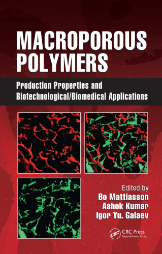 Macroporous Polymers: Production Properties and Biotechnological Biomedical Applications
