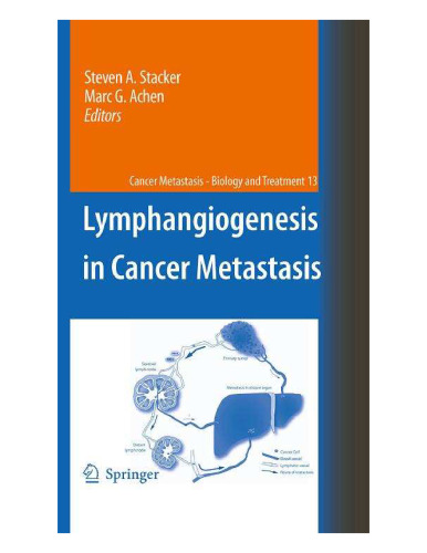 Lymphangiogenesis in Cancer Metastasis