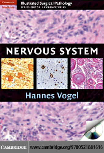 Nervous System (Cambridge Illustrated Surgical Pathology)
