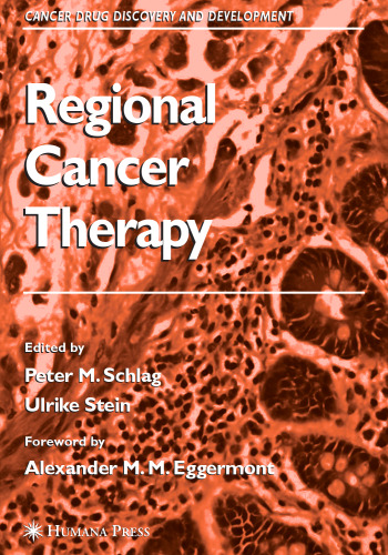 Regional Cancer Therapy (Cancer Drug Discovery and Development)