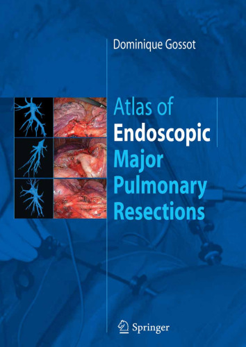 Atlas of Endoscopic Major Pulmonary Resections