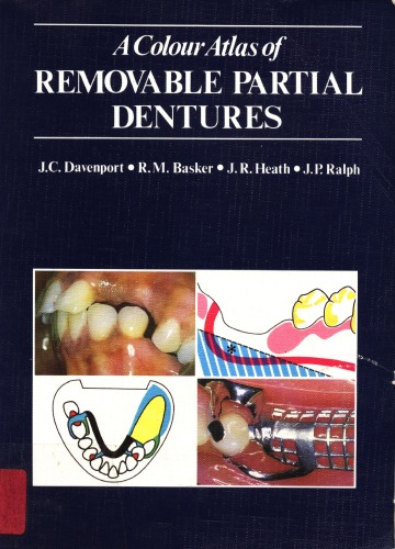 A Colour Atlas of Removable Partial Dentures