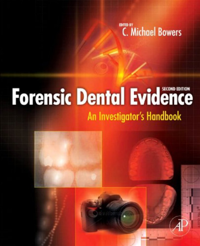 Forensic Dental Evidence, Second Edition: An Investigator's Handbook