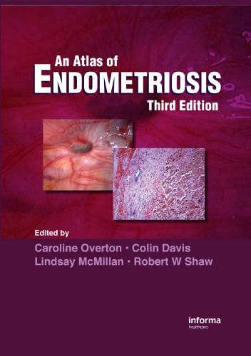 Atlas of Endometriosis, Third Edition ( Encyclopedia of Visual Medicine)