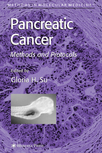 Pancreatic Cancer: Methods and Protocols (Methods in Molecular Medicine)