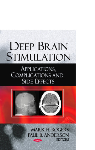 Deep Brain Stimulation: Applications, Complications and Side Effects