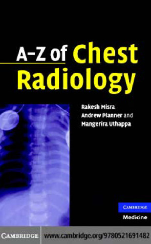A-Z of Chest Radiology