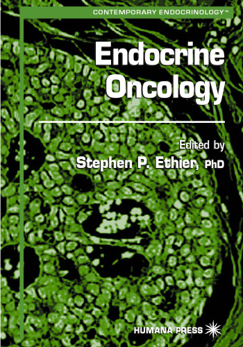 Endocrine Oncology (Contemporary Endocrinology)