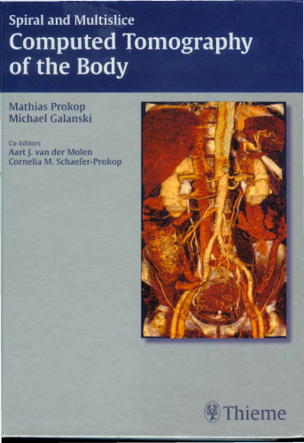Spiral and Multislice Computed Tomography of the Body ( THIEME )