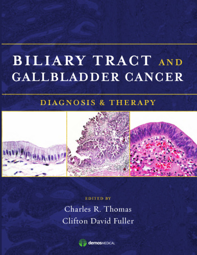 Biliary Tract and Gallbladder Cancer: Diagnosis & Therapy