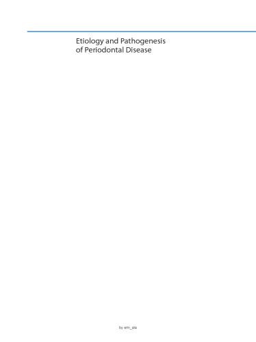 Etiology and Pathogenesis of Periodontal Disease