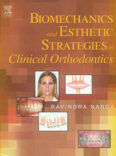 Biomechanics and Esthetic Strategies in Clinical Orthodontics