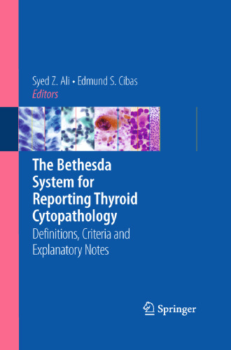The Bethesda System for Reporting Thyroid Cytopathology: Definitions, Criteria and Explanatory Notes