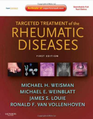 Targeted Treatment of the Rheumatic Diseases