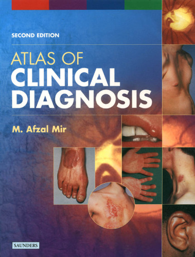 Atlas of Clinical Diagnosis, 2nd Edition