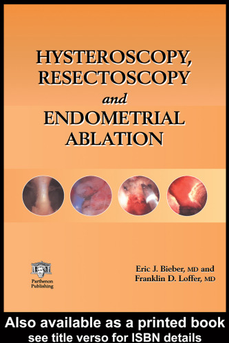 Hysteroscopy, Resectoscopy and Endometrial Ablation
