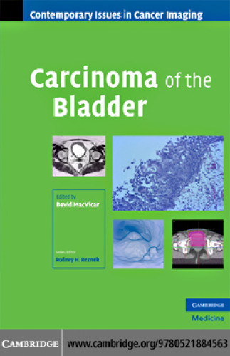 Carcinoma of the Bladder (Contemporary Issues in Cancer Imaging)