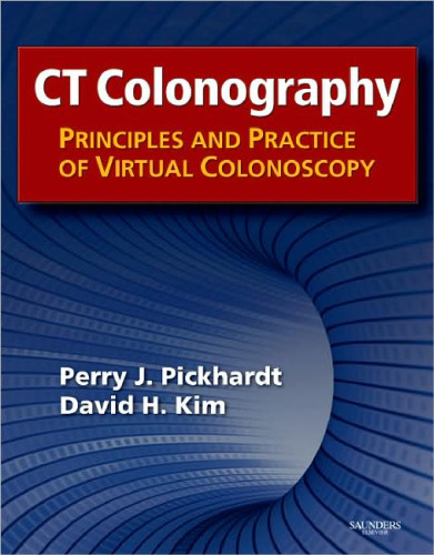 CT Colonography: Principles and Practice of Virtual Colonoscopy