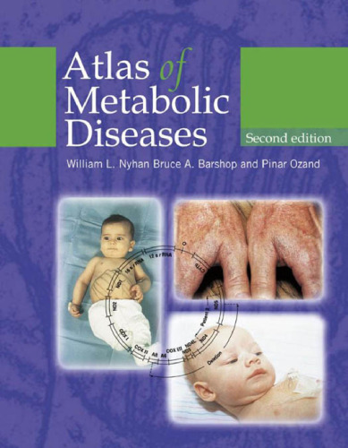 Atlas of Metabolic Diseases, 2nd Edition