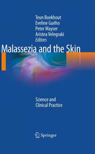 Malassezia and the Skin: Science and Clinical Practice