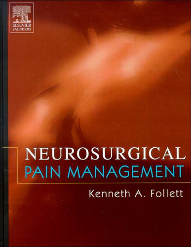 Neurosurgical Pain Management