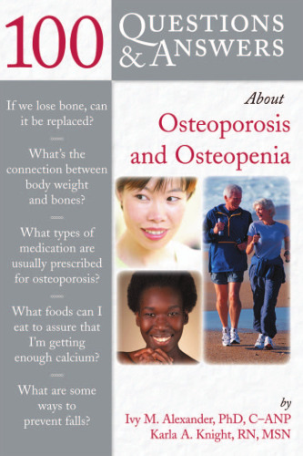 100 Questions & Answers About Osteoporosis and Osteopenia (100 Questions Series)