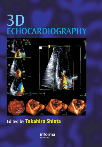 3D Echocardiography